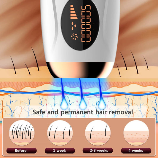 Portable IPL Laser Epilator 999999 Flashes